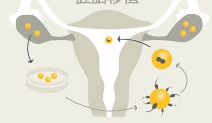 在耒阳市做试管婴儿长方案周期需要多久？超长方案促排流程是怎么样的？